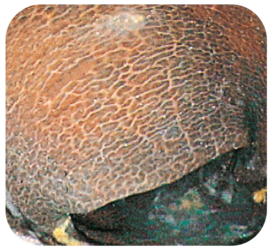 Bild 10. Typiskt “leopardmönster” vid melanosis coli.